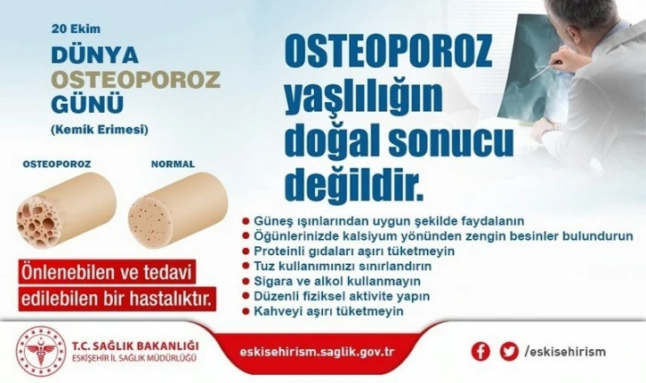 20 Ekim Dünya Osteoporoz Günü
