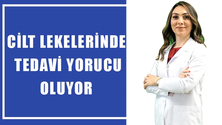 Cilt lekelerinde tedavi yorucu oluyor