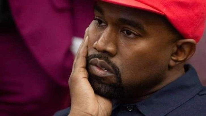 Kanye West dövmesi yaptıranlara ücretsiz sildirme imkanı