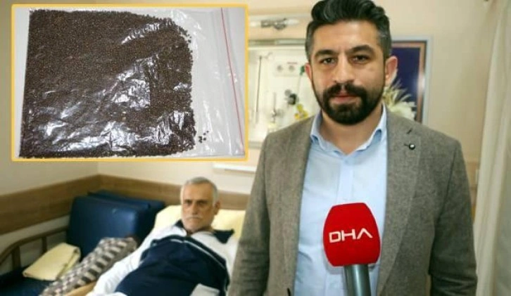 Tarihi rekor: Karın ağrısı şikayetiyle gitti, safra kesesinden 14 bin taş çıktı!