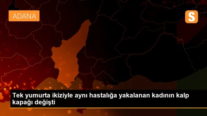 Tek yumurta ikiziyle aynı hastalığa yakalanan kadının kalp kapağı değişti