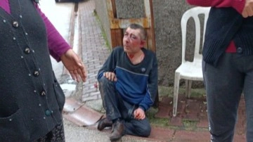 Adana'da fırın çalışanını acımasızca dövüp, kan revan içinde evinin önüne attılar