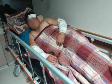 Konya’da köpeklerin kovaladığı çocuk bisikletten düşüp yaralandı
