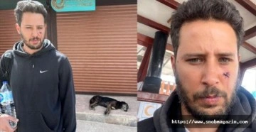 Tuan Tunalı'nın Yüzünü Köpek Isırdı