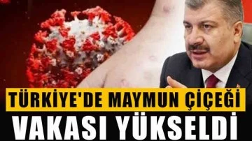 Türkiye'de maymun çiçeği vakası yükseldi