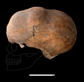 Yassıhöyük’te 6 bin yıllık kafatası bulundu
