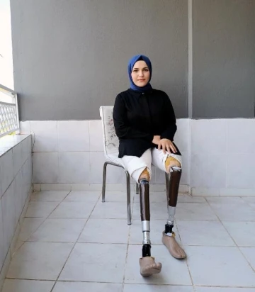 Zeynep'ten yeni protez bacakları için başlattığı yardım kampanyasına destek çağrısı
